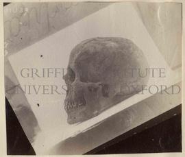 [89] Painted Roman head - skull - side